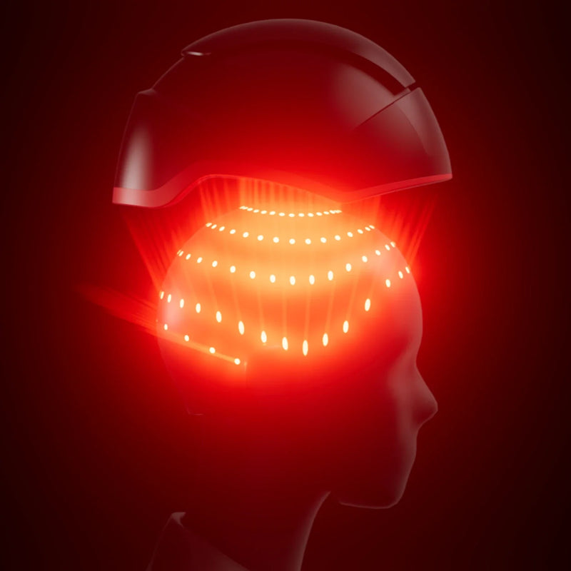 iRESTORE Elite Laser Hair Growth System