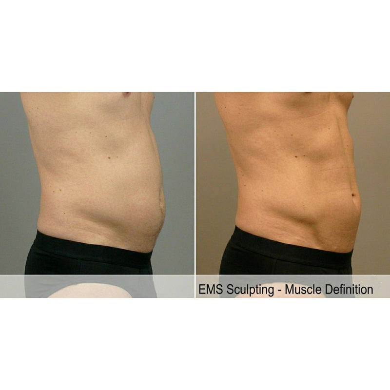 Kavvia Tone Wave EMS Body Sculpting