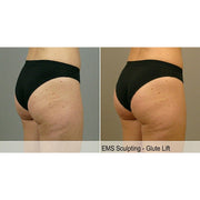 Kavvia Tone Wave EMS Body Sculpting