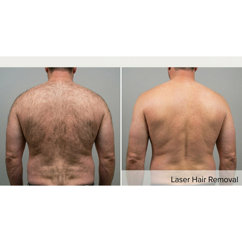 Kavvia DermaLux Diode Laser