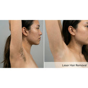 Kavvia DermaLux Diode Laser
