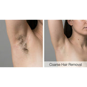 Kavvia Dualis X ND:YAG Laser