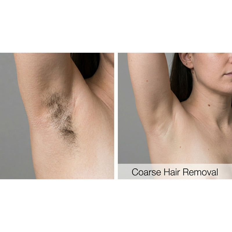 Kavvia Dualis X ND:YAG Laser