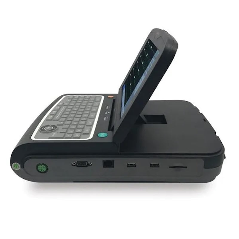 Infinium QRS-12 Portable ECG Monitor