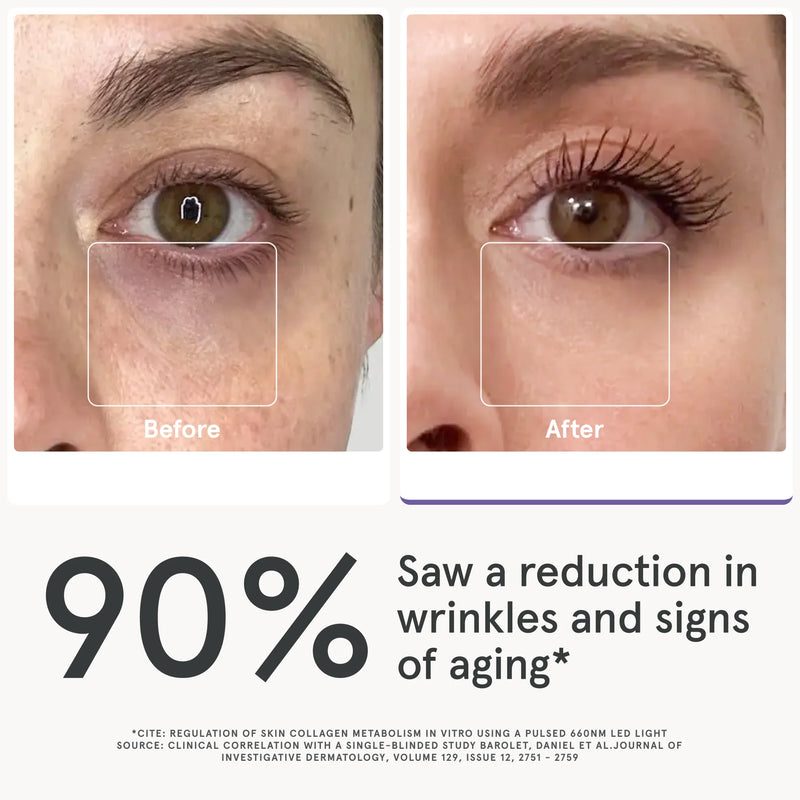 iRESTORE Illumina Eye Mask