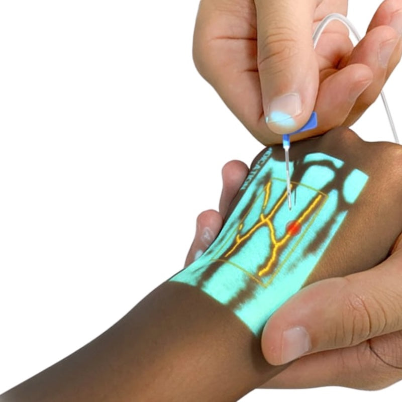 Infinium VS500 Infrared Vein Viewer