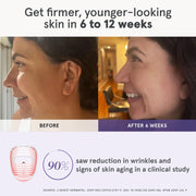 iRESTORE Illumina Face Mask