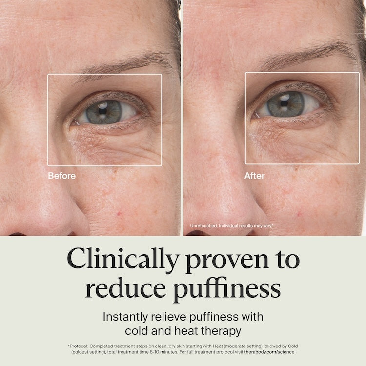 Therabody TheraFace Depuffing Wand