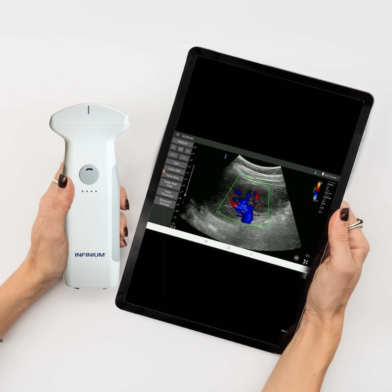 Infinium VioScan C7 – Convex Handheld Ultrasound