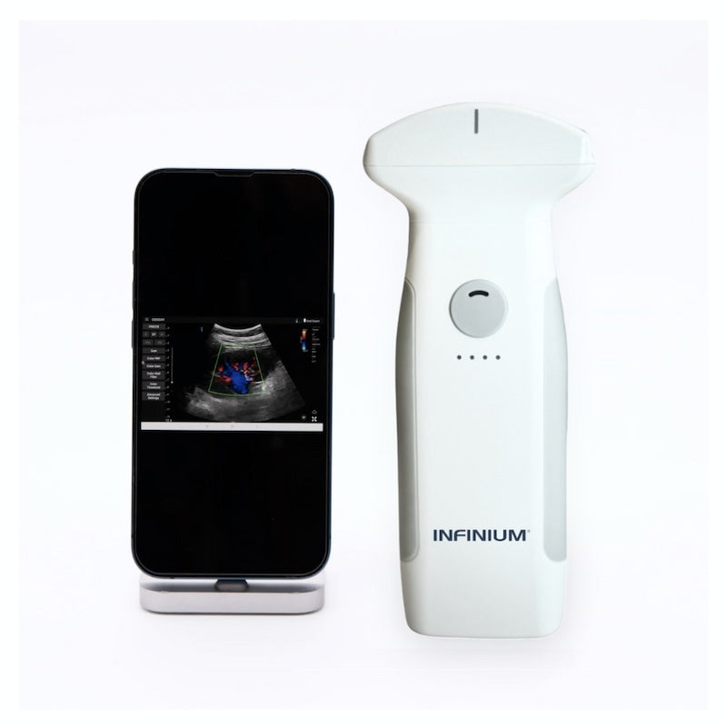 Infinium VioScan C7 – Convex Handheld Ultrasound