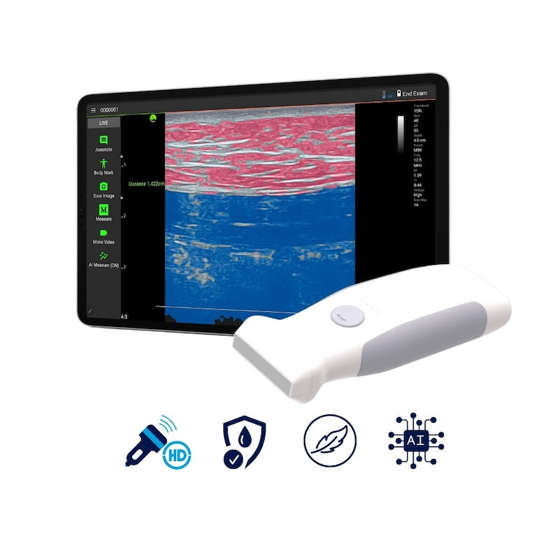 Infinium VioScan L2 – Wireless Handheld Linear Ultrasound