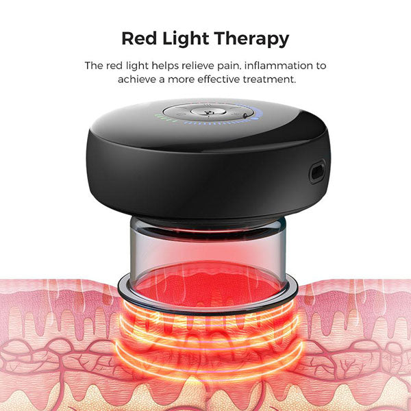 Achedaway Cupper Smart Cupping Therapy Massager — Recovery For